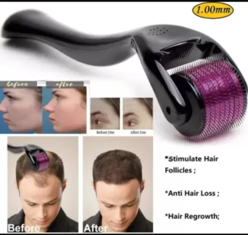 Derma Roller For Hair Growth & Acne Scars Results