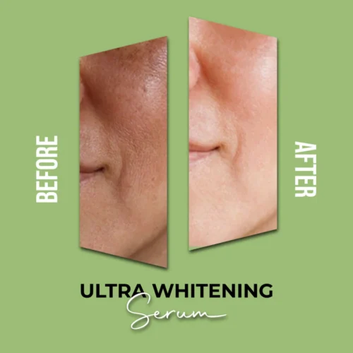 Ultra Whitening Serum results