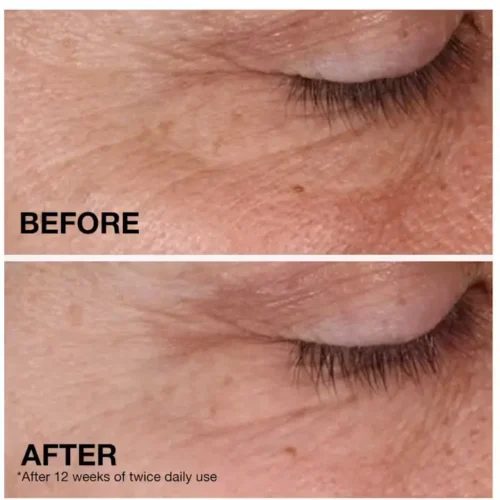 Neutrogena Retinol Regenerating Cream Effects