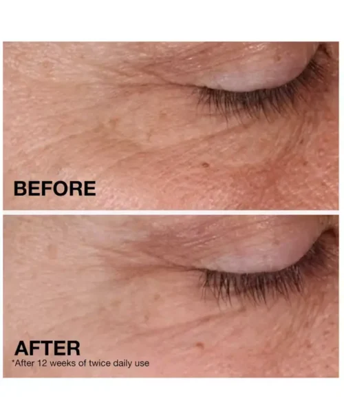 Neutrogena Retinol Regenerating Cream Effects